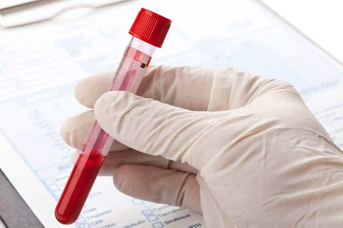 Trasporto sangue con droni riuscito in Italia
